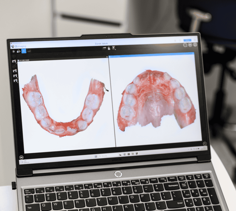 Skan 3D zamiast przestarzałych wycisków